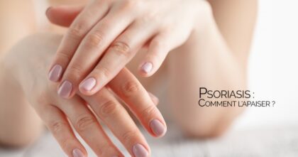 Psoriasis, comment l’apaiser ?